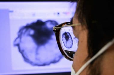 Megtalálták a daganatok gyenge pontját, hatásosabb lehet az immunterápia