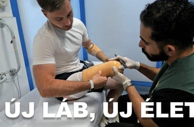 Amputálták a lábukat Ukrajnában, újat kaptak Magyarországon - videó
