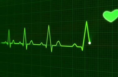 Ránéz az EKG-ra, 2 mp alatt azonosítja a szívbetegségeket az új mesterséges intelligencia