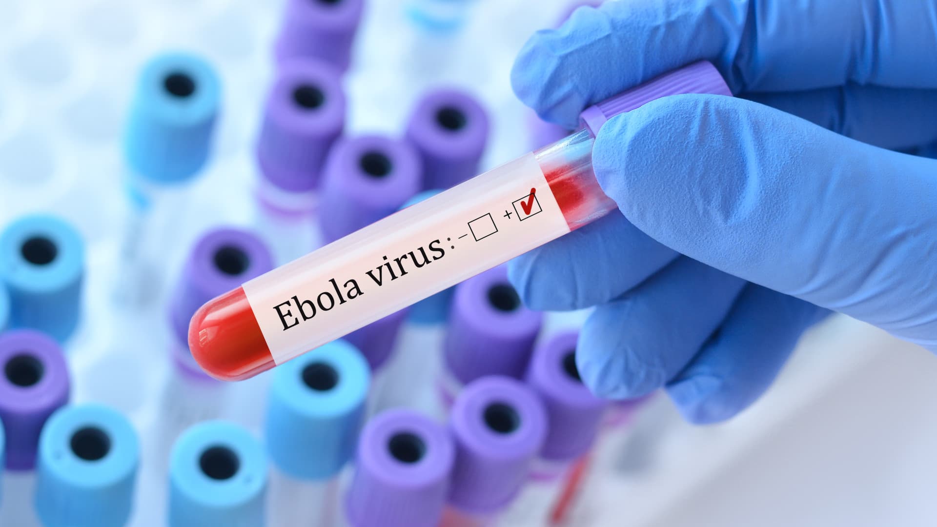 Nagyon magas az ebola halálozási aránya