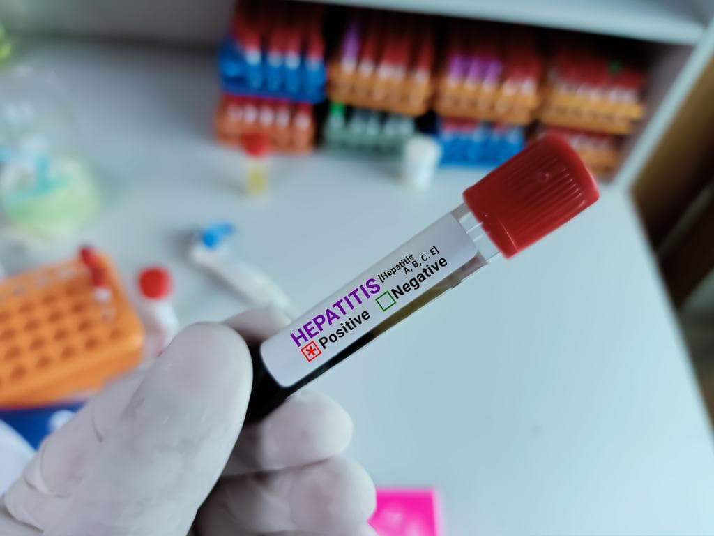 Hepatitis: az uniós átlagnál jóval rosszabb a magyar helyzet